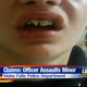 Amy Olzak’s 12-year-old son suffered broken teeth after an Idaho Falls, Idaho, police officer allegedly slammed his face into the trunk of a car March 13, 2016.
KIDK